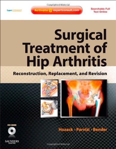 Surgical treatment of hip arthritis book cover