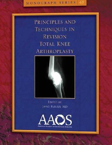 Priciples and Techniques in Revision Total Knee Arthroplasty